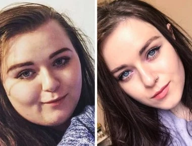 Το πριν και το μετά - Πώς αυτοί οι άνθρωποι έγιναν αγνώριστοι (φώτο)